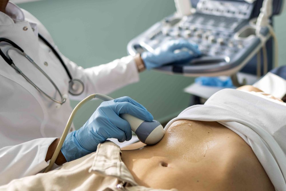 FibroScan