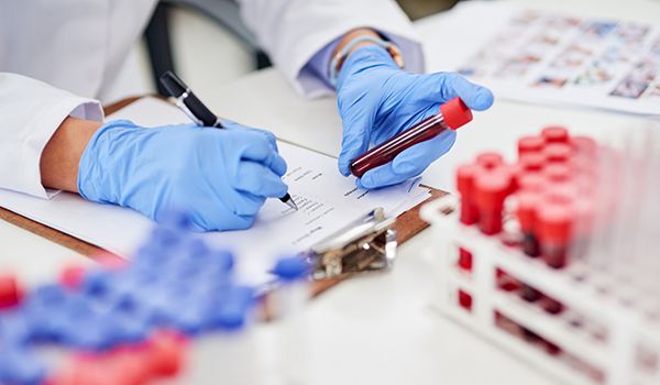 Lab tests