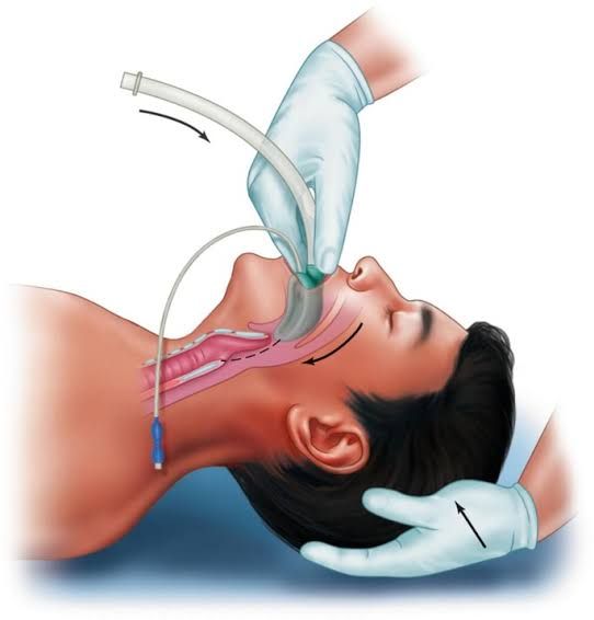 Endoscopy